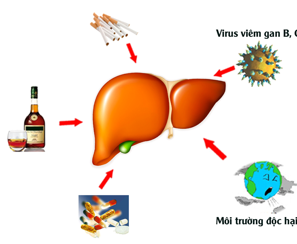 1518430238_598_giam-tieu-cau-moi-nguy-hai-khon-luong-tu-can-benh-xo-gan